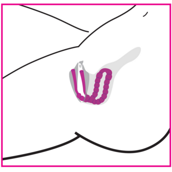 Petal Pusher - Silicone Labia Spreader